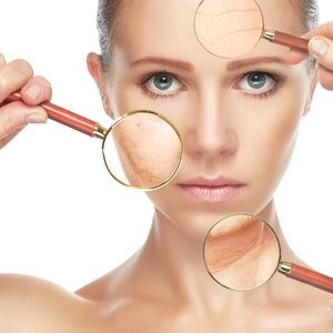Radio Frequency Skin Lifting&Tightening